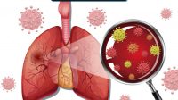 cara mencegah pneumonia